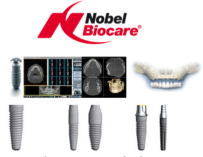 loai – co implant se do he thong may tinh sau khi de xuat sau khi phan tich phim ct
