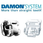 damon system clear - Nha khoa Lan Anh