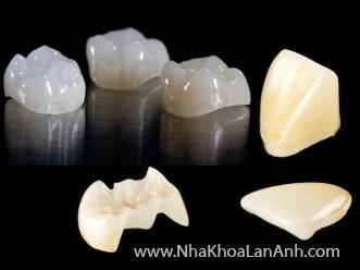 rang-toan-su-tai-nha-khoa-lan-anh