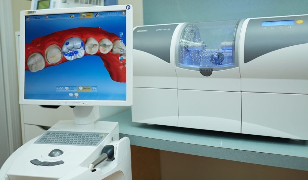 he thong may cerec lam rang su