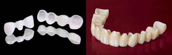 rang su zirconia co suon zirconia va phu mot lop su ben ngoai