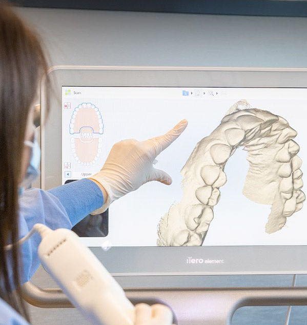 Mô phỏng kết quả niềng răng Invisalign hoạt động như thế nào?