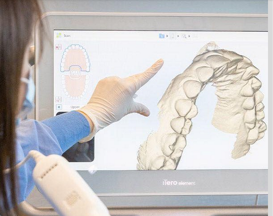 Implant, nhổ răng, phẫu thuật