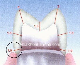 Co rang dieu chinh veneer