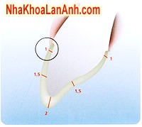 mo rang veneer