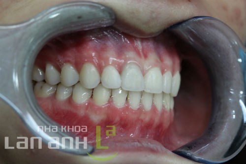 thao mac cai chinh nha