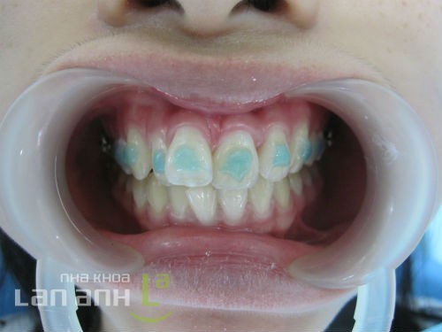 phan tich mau ham chinh nha